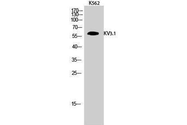 anti-Potassium Voltage-Gated Channel, Shaw-Related Subfamily, Member 1 (KCNC1) (Internal Region) antibody