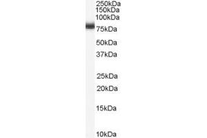 anti-Numb Homolog (NUMB) (C-Term) antibody