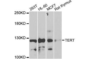 Image no. 4 for anti-Telomerase Reverse Transcriptase (TERT) antibody (ABIN1875058)