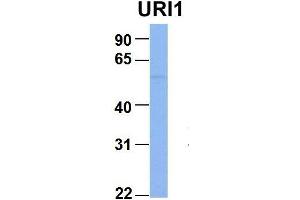 anti-URI1, Prefoldin-Like Chaperone (URI1) (Middle Region) antibody