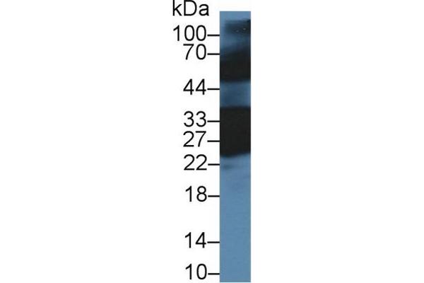 CRYBB1 antibody  (AA 6-186)