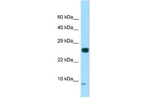Image no. 1 for anti-SPANX Family, Member C (SPANXC) (N-Term) antibody (ABIN2788255)