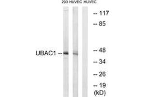 Image no. 1 for anti-UBA Domain Containing 1 (UBAC1) (AA 91-140) antibody (ABIN1535446)