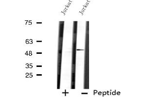 Image no. 1 for anti-Arrestin, beta 1 (ARRB1) (C-Term) antibody (ABIN6256941)