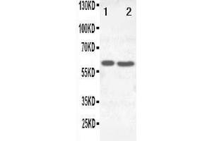 Image no. 1 for anti-Solute Carrier Family 22 Member 6 (SLC22A6) (AA 534-550), (C-Term) antibody (ABIN3044261)