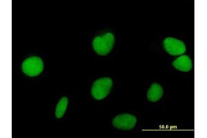 Immunofluorescence of purified MaxPab antibody to ZNF573 on HeLa cell.