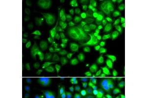 Immunofluorescence analysis of A549 cells using SNX3 Polyclonal Antibody