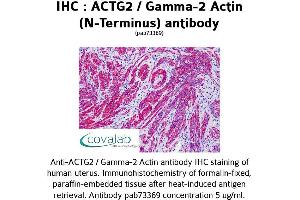 Image no. 1 for anti-Actin, gamma 2, Smooth Muscle, Enteric (ACTG2) antibody (ABIN1731474)