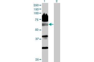 Image no. 1 for anti-BTB (POZ) Domain Containing 14A (BTBD14A) (AA 1-587) antibody (ABIN530749)