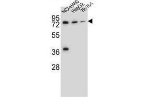 Image no. 3 for anti-UDP Glucuronosyltransferase 2 Family, Polypeptide B15 (UGT2B15) (AA 163-193), (Middle Region) antibody (ABIN955443)