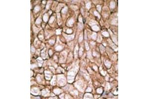 Image no. 2 for anti-Pyruvate Dehydrogenase Complex, Component X (PDHX) (C-Term) antibody (ABIN357414)