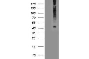 Image no. 3 for anti-Lysophosphatidic Acid Receptor 1 (LPAR1) antibody (ABIN1499191)