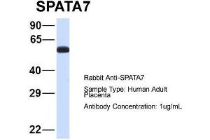 Image no. 3 for anti-Spermatogenesis Associated 7 (SPATA7) (Middle Region) antibody (ABIN2787132)