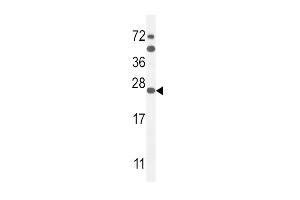 Image no. 1 for anti-Sodium Channel, Voltage-Gated, Type I, beta (SCN1B) (AA 63-90), (N-Term) antibody (ABIN654602)