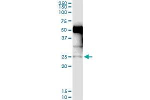 Image no. 1 for anti-Nucleoredoxin Like Protein 1 (NXNL1) (AA 1-212) antibody (ABIN530365)