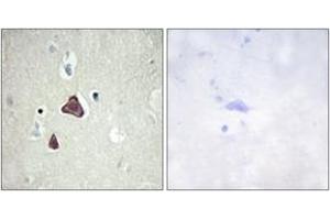 Image no. 1 for anti-Adenylate Cyclase 8 (Brain) (ADCY8) (AA 591-640) antibody (ABIN1534257)