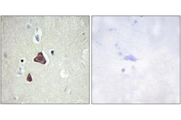 anti-Adenylate Cyclase 8 (Brain) (ADCY8) (AA 591-640) antibody