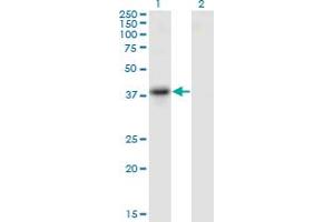 Image no. 2 for anti-serpin Peptidase Inhibitor, Clade B (Ovalbumin), Member 10 (SERPINB10) (AA 46-145) antibody (ABIN1774812)