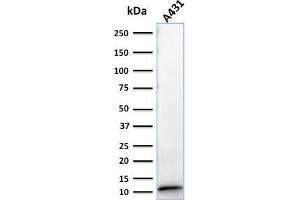 Image no. 1 for anti-S100 Calcium Binding Protein A2 (S100A2) antibody (ABIN6940540)