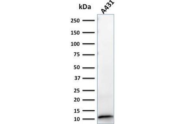 anti-S100 Calcium Binding Protein A2 (S100A2) antibody