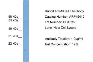 Image no. 1 for anti-Sterol O-Acyltransferase 1 (SOAT1) (Middle Region) antibody (ABIN2782210)