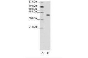 Image no. 1 for anti-PiggyBac Transposable Element Derived 1 (PGBD1) (N-Term) antibody (ABIN202923)