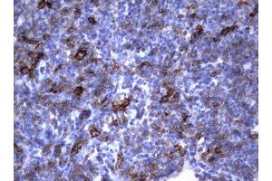 Image no. 3 for anti-Fc Fragment of IgE, Low Affinity II, Receptor For (CD23) (FCER2) (AA 48-321) antibody (ABIN1491554)