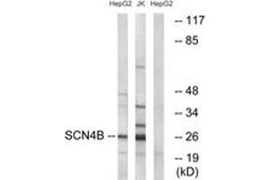 Image no. 1 for anti-Sodium Channel, Voltage-Gated, Type IV, beta Subunit (SCN4B) (AA 61-110) antibody (ABIN1535376)