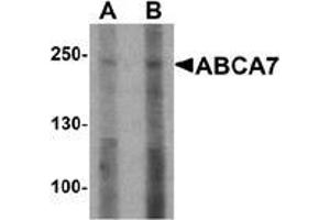 Image no. 2 for anti-ATP-Binding Cassette, Sub-Family A (ABC1), Member 7 (ABCA7) (N-Term) antibody (ABIN1449921)