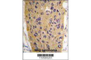 Image no. 2 for anti-WNT Inhibitory Factor 1 (WIF1) (AA 347-376), (C-Term) antibody (ABIN389185)