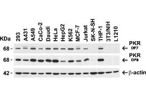 Image no. 1 for anti-Eukaryotic Translation Initiation Factor 2-alpha Kinase 2 (EIF2AK2) (N-Term) antibody (ABIN6657000)