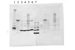 Image no. 1 for anti-Desmoplakin (DSP) antibody (ABIN1742177)