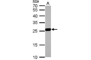Image no. 1 for anti-Glutathione S-Transferase mu 1 (GSTM1) (Center) antibody (ABIN2856903)