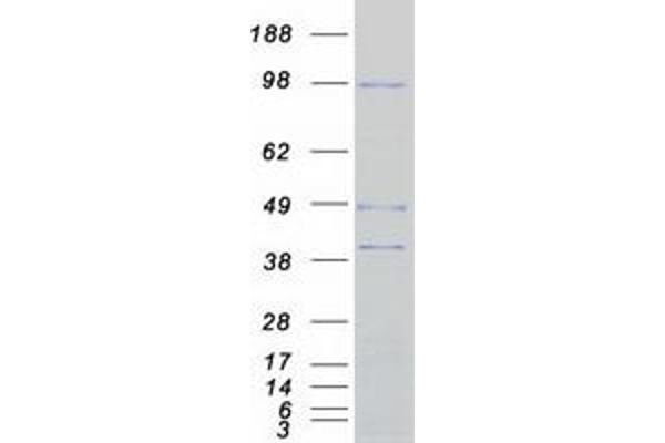 ARHGEF15 Protein (rho Guanine Nucleotide Exchange Factor (GEF) 15) (Myc-DYKDDDDK Tag)