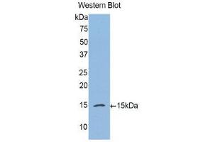 Image no. 1 for anti-Complement Factor B (CFB) (AA 270-388) antibody (ABIN1175357)
