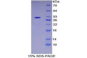 Image no. 1 for Checkpoint Kinase 2 (CHEK2) (AA 300-540) protein (His tag) (ABIN1878499)