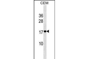 ADM2 Antibody (N-term) (ABIN1539062 and ABIN2849503) western blot analysis in CEM cell line lysates (35 μg/lane).