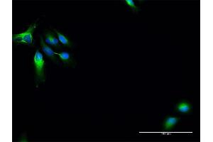 Image no. 2 for anti-Microtubule-Associated Protein 7 (MAP7) (AA 1-749) antibody (ABIN948765)