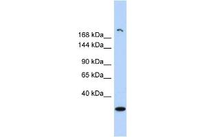 Image no. 1 for anti-Ubiquitously Transcribed Tetratricopeptide Repeat Gene, Y-Linked (UTY) (Middle Region) antibody (ABIN2787595)