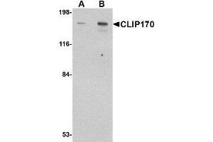 Image no. 2 for anti-CAP-GLY Domain Containing Linker Protein 1 (CLIP1) (C-Term) antibody (ABIN499641)