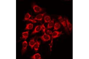 Image no. 1 for anti-Patched 1 (PTCH1) antibody (ABIN6264047)