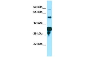 Image no. 1 for anti-Spastic Paraplegia 21 (SPG21) (C-Term) antibody (ABIN2790234)