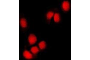 Image no. 2 for anti-Ring Finger Protein 2 (RNF2) (full length) antibody (ABIN6005194)