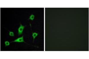 Image no. 2 for anti-Retinol Binding Protein 5, Cellular (RBP5) (AA 10-59) antibody (ABIN1533811)