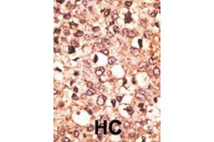 CRY1 antibody  (C-Term)