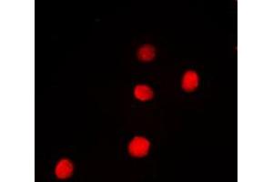 Image no. 1 for anti-Paired Box 9 (PAX9) (Center) antibody (ABIN2706773)