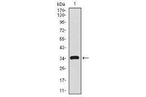 Image no. 2 for anti-CD59 (CD59) antibody (ABIN1491388)