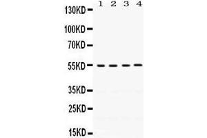Image no. 1 for anti-Flavin Containing Monooxygenase 2 (Non-Functional) (FMO2) (AA 78-115), (N-Term) antibody (ABIN3042397)