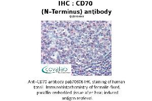 Image no. 1 for anti-CD70 Molecule (CD70) (N-Term) antibody (ABIN1732877)
