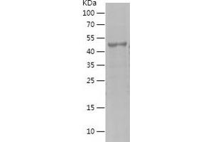MAGEA1 Protein (AA 161-309) (His-IF2DI Tag)